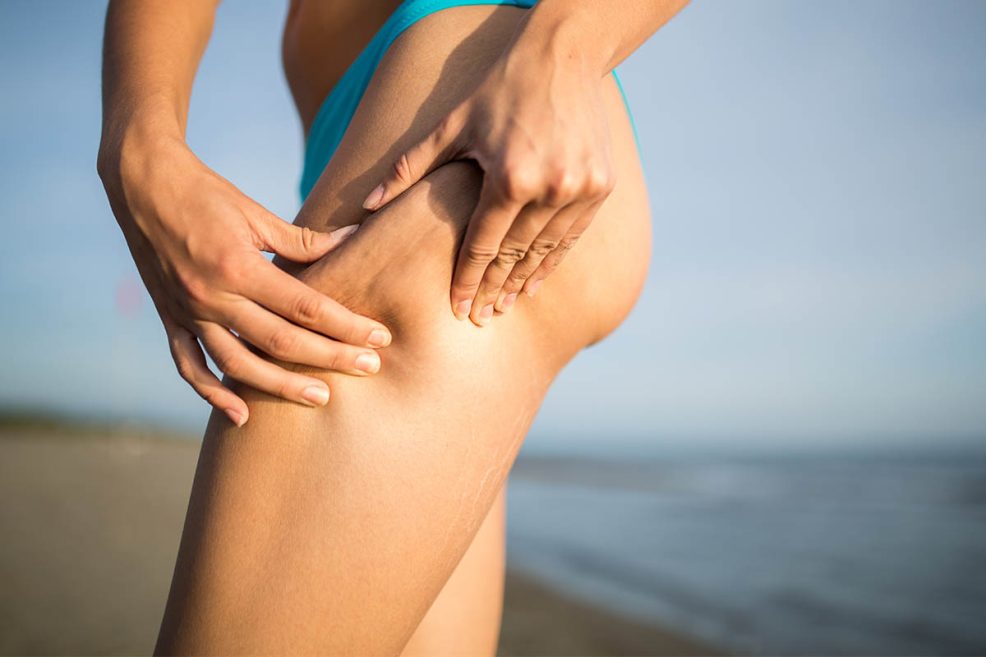 tratamientos corporales reafirmantes - cristina alvarez celulitis verano